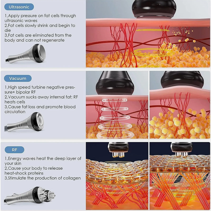 Bio Healing 40K Cavitation & RF Fat Reduction Machine