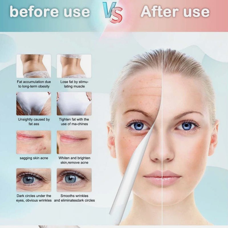 9 - in - 1 Ultrasonic Cavitation & RF Body Contouring Beauty Machine (80K Technology)