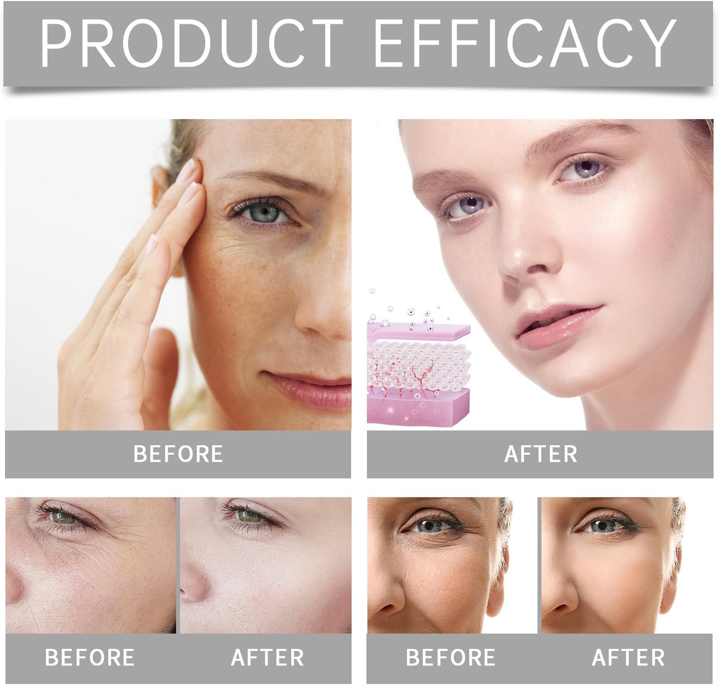 Anti-aging microneedle device