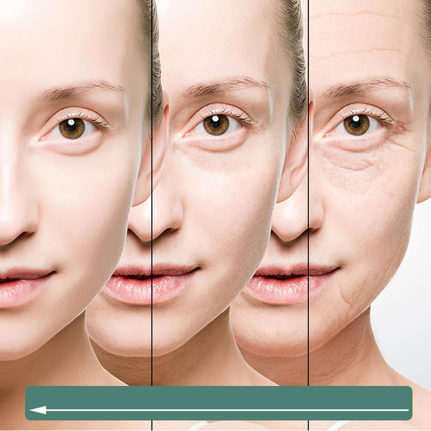 At-home micro-needling kit