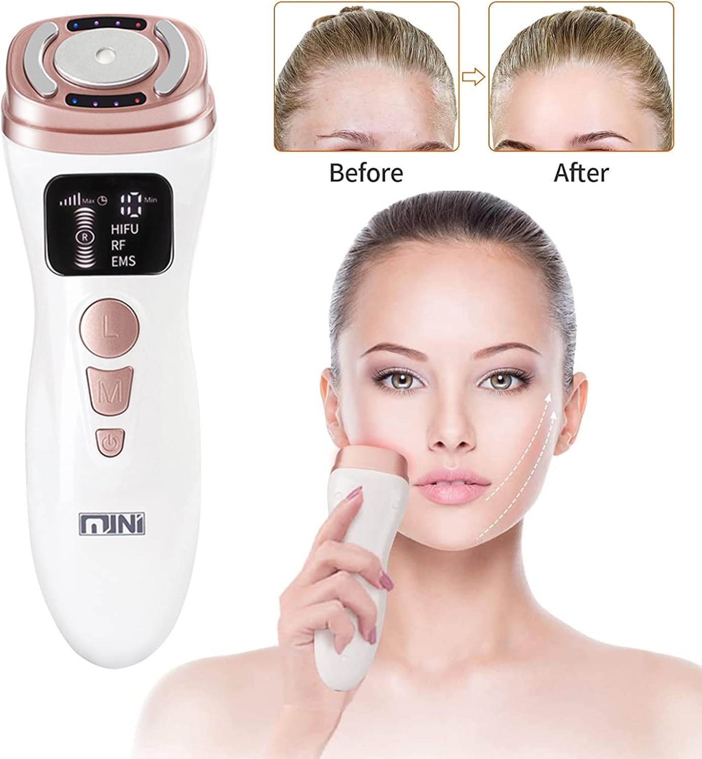 Mini RF EMS Facial Lifting Machine