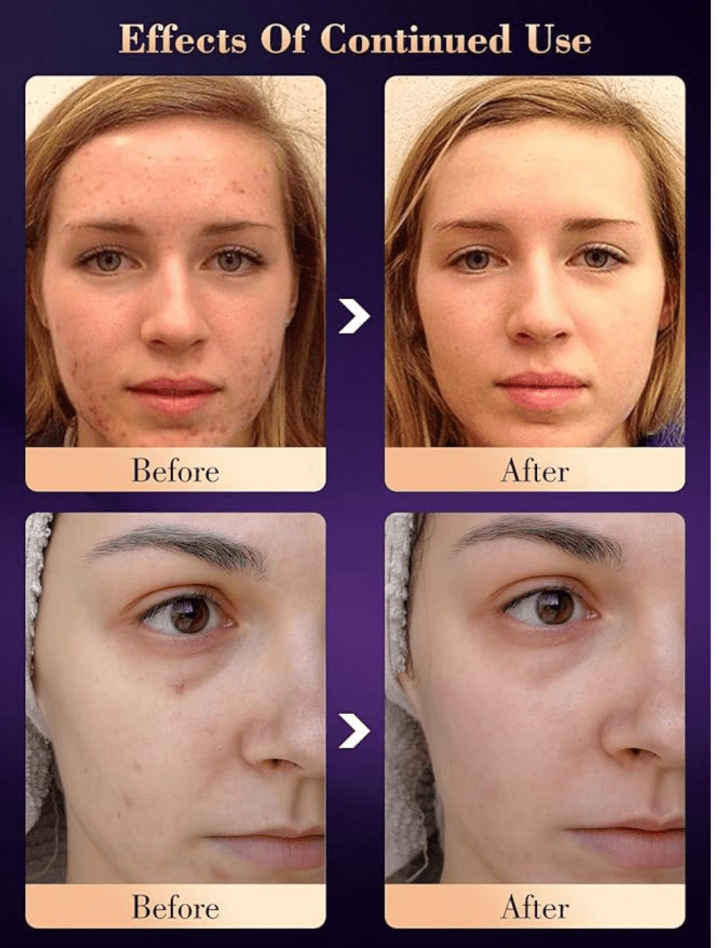 Red light therapy mask